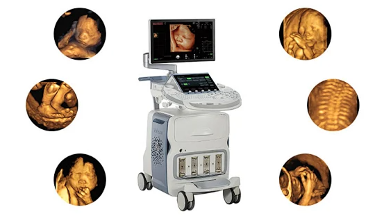 汕头彩超怎么样四维彩超啥时候预约？它检查什么？看了这篇全明白！『汕头妇产科医院』_https://www.jmylbn.com_新闻资讯_第2张