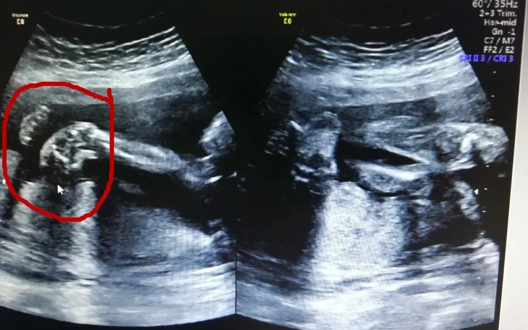 汕头彩超怎么样四维彩超啥时候预约？它检查什么？看了这篇全明白！『汕头妇产科医院』_https://www.jmylbn.com_新闻资讯_第4张