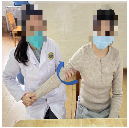 上肢怎么康复【手功能基地系列微文148】卒中后上运动神经元综合征之上肢痉挛的康复管理_https://www.jmylbn.com_新闻资讯_第11张