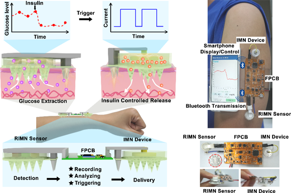 中山大学谢曦教授课题组《Adv. Sci.》：在微针阵列可穿戴设备领域取得新进展的图1
