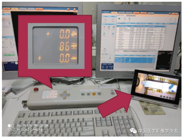 方舱ct怎么取新型冠状病毒肺炎专题 ｜ 洪楠：遥控摆位的可视化系统（自制天眼）在新型冠状病毒肺炎CT检查中的应用_https://www.jmylbn.com_新闻资讯_第5张