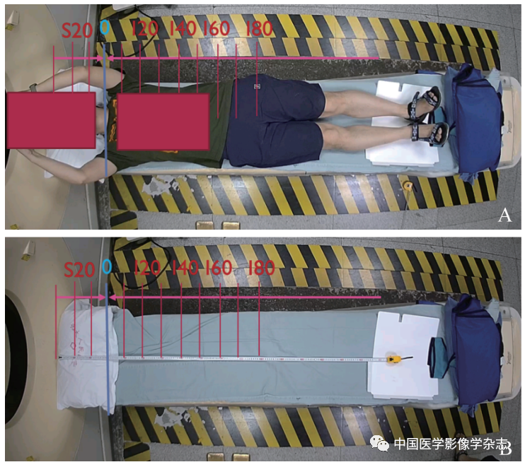 方舱ct怎么取新型冠状病毒肺炎专题 ｜ 洪楠：遥控摆位的可视化系统（自制天眼）在新型冠状病毒肺炎CT检查中的应用_https://www.jmylbn.com_新闻资讯_第6张