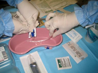 怎么拔鼻腔引流管胃管术（二）_https://www.jmylbn.com_新闻资讯_第24张