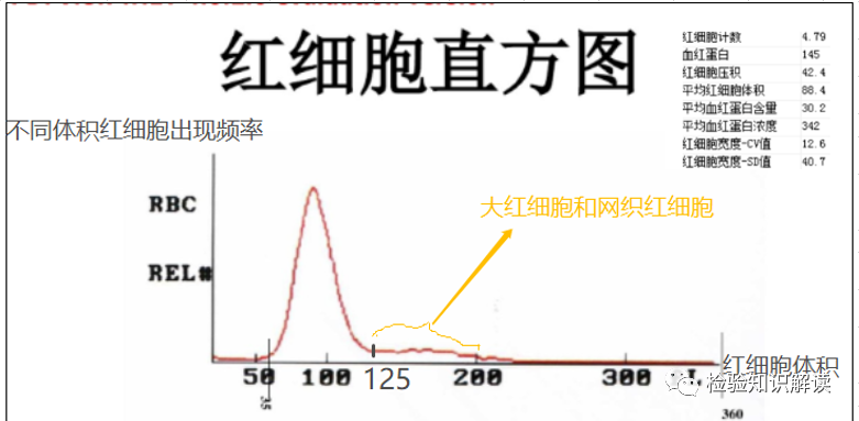 rbc直方图怎么看红细胞／血小板直方图结果解读_https://www.jmylbn.com_新闻资讯_第2张