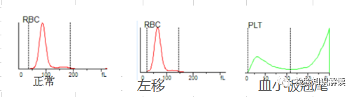 rbc直方图怎么看红细胞／血小板直方图结果解读_https://www.jmylbn.com_新闻资讯_第4张