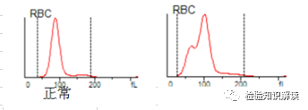 rbc直方图怎么看红细胞／血小板直方图结果解读_https://www.jmylbn.com_新闻资讯_第6张