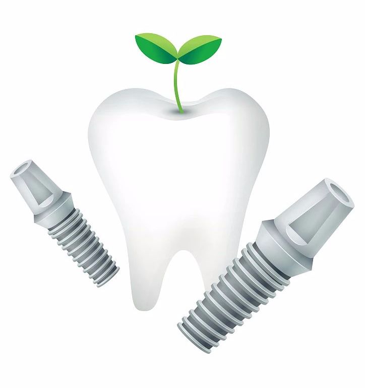 种植牙要想用一生，这些“功课”你做了吗？