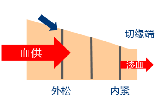 吻合器怎么用一次性使用腔镜切割吻合器操作要点（续）_https://www.jmylbn.com_新闻资讯_第3张