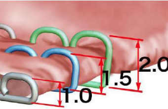 吻合器怎么用一次性使用腔镜切割吻合器操作要点（续）_https://www.jmylbn.com_新闻资讯_第4张