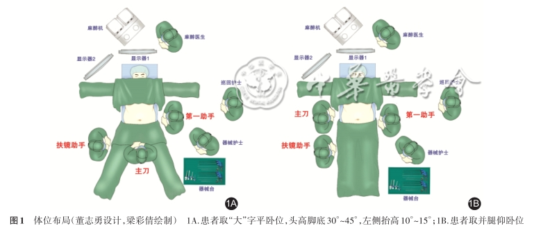 胃肠吻合需要哪些器械【指南与共识】腹腔镜单吻合口胃旁路术规范化手术操作指南（2022版）_https://www.jmylbn.com_新闻资讯_第1张