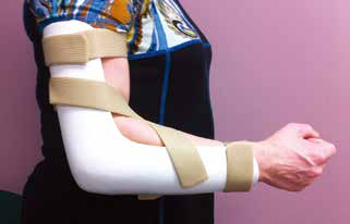 肘关节康复器怎么用全肘关节置换术--AAOS骨科术后康复指南_https://www.jmylbn.com_新闻资讯_第20张