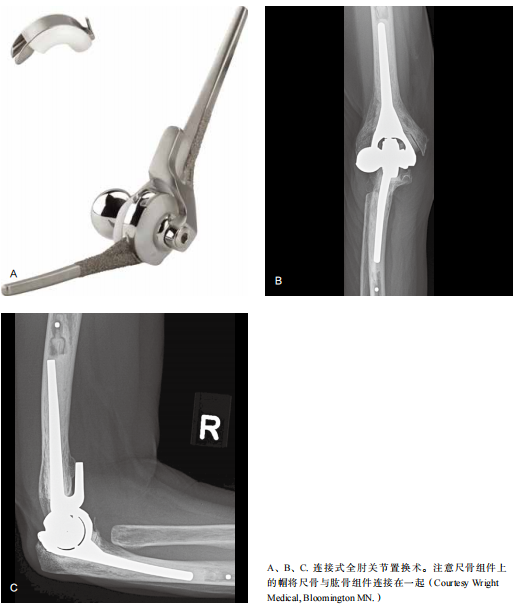 肘关节康复器怎么用全肘关节置换术--AAOS骨科术后康复指南_https://www.jmylbn.com_新闻资讯_第3张