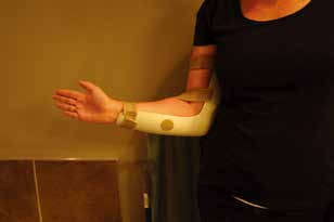 肘关节康复器怎么用全肘关节置换术--AAOS骨科术后康复指南_https://www.jmylbn.com_新闻资讯_第22张