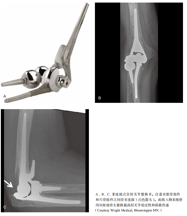 肘关节康复器怎么用全肘关节置换术--AAOS骨科术后康复指南_https://www.jmylbn.com_新闻资讯_第4张