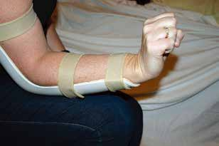 肘关节康复器怎么用全肘关节置换术--AAOS骨科术后康复指南_https://www.jmylbn.com_新闻资讯_第24张