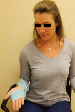 肘关节固定支具怎么用肘关节脱位切开复位内固定术后康复：AAOS骨科术后康复指南_https://www.jmylbn.com_新闻资讯_第14张