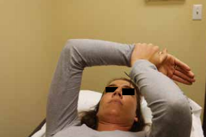 肘关节固定支具怎么用肘关节脱位切开复位内固定术后康复：AAOS骨科术后康复指南_https://www.jmylbn.com_新闻资讯_第7张