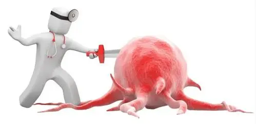 胰腺癌一旦发现就是中晚期？预防这10大癌症记得做这些筛查！