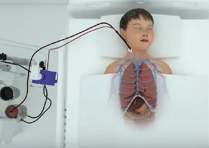 医用高分子 ——EMCO膜材料