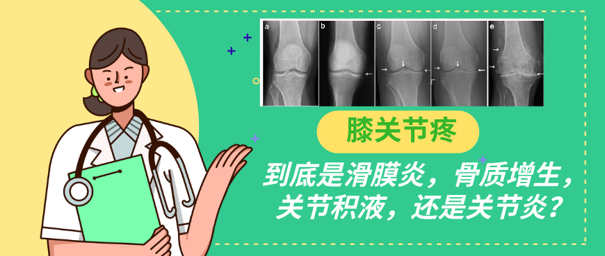 膝关节疼，到底是滑膜炎，骨质增生，关节积液，还是关节炎？