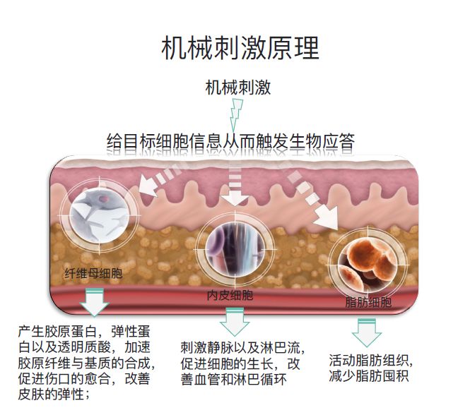 康复振动仪怎么使用产后康复让您重拾健康美丽—我院引进LPG负压振动理疗仪_https://www.jmylbn.com_新闻资讯_第4张
