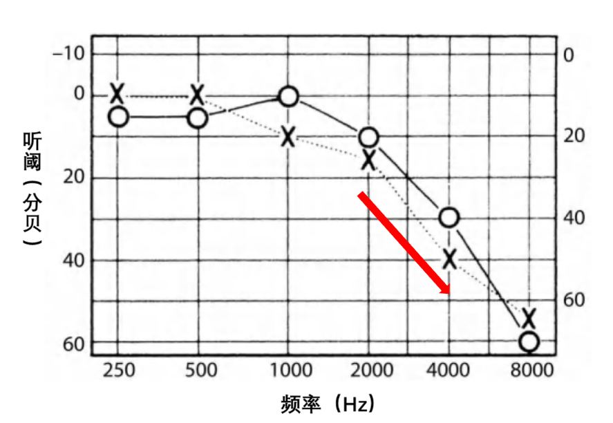 听力AC为什么0什么？我的听力已经提早“退休”了？_https://www.jmylbn.com_新闻资讯_第5张