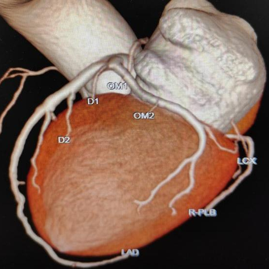 X光拍片为什么要等CT、MR、X光报告为什么不是“拍完就取”？_https://www.jmylbn.com_新闻资讯_第3张