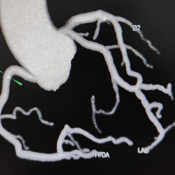 X光拍片为什么要等CT、MR、X光报告为什么不是“拍完就取”？_https://www.jmylbn.com_新闻资讯_第4张