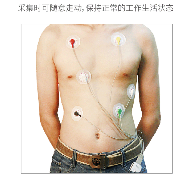 动态心电图自己怎么记录24小时动态心电图，做还是不做？_https://www.jmylbn.com_新闻资讯_第3张