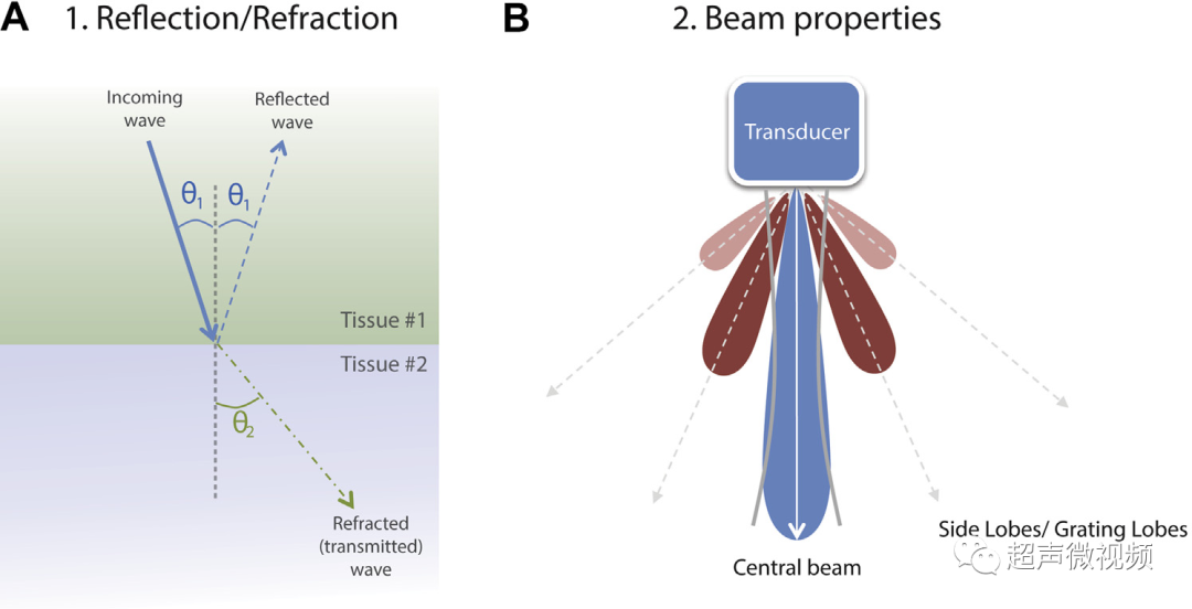 彩超伪像是什么心脏超声伪像有哪些？如何识别它们？_https://www.jmylbn.com_新闻资讯_第3张