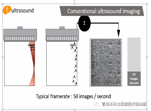 什么叫超声容积探头医学超声成像原理及设备维护（一）_https://www.jmylbn.com_新闻资讯_第9张