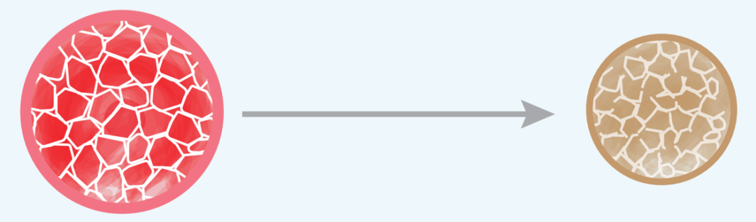 栓塞器材有哪些器械百科丨IMPEDE-FX RapidFill装置_https://www.jmylbn.com_新闻资讯_第15张
