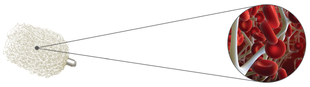 栓塞器材有哪些器械百科丨IMPEDE-FX RapidFill装置_https://www.jmylbn.com_新闻资讯_第14张