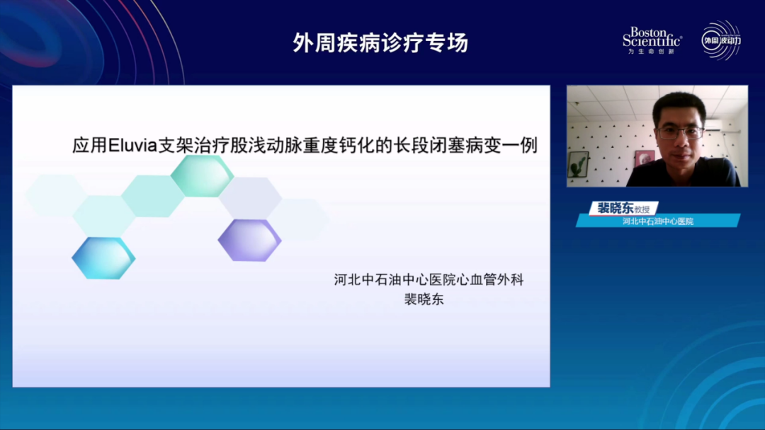 波科支架怎么样精彩荟萃 ｜ 波士顿科学 外周波动力【下肢篇】@中国南方血管大会_https://www.jmylbn.com_新闻资讯_第5张