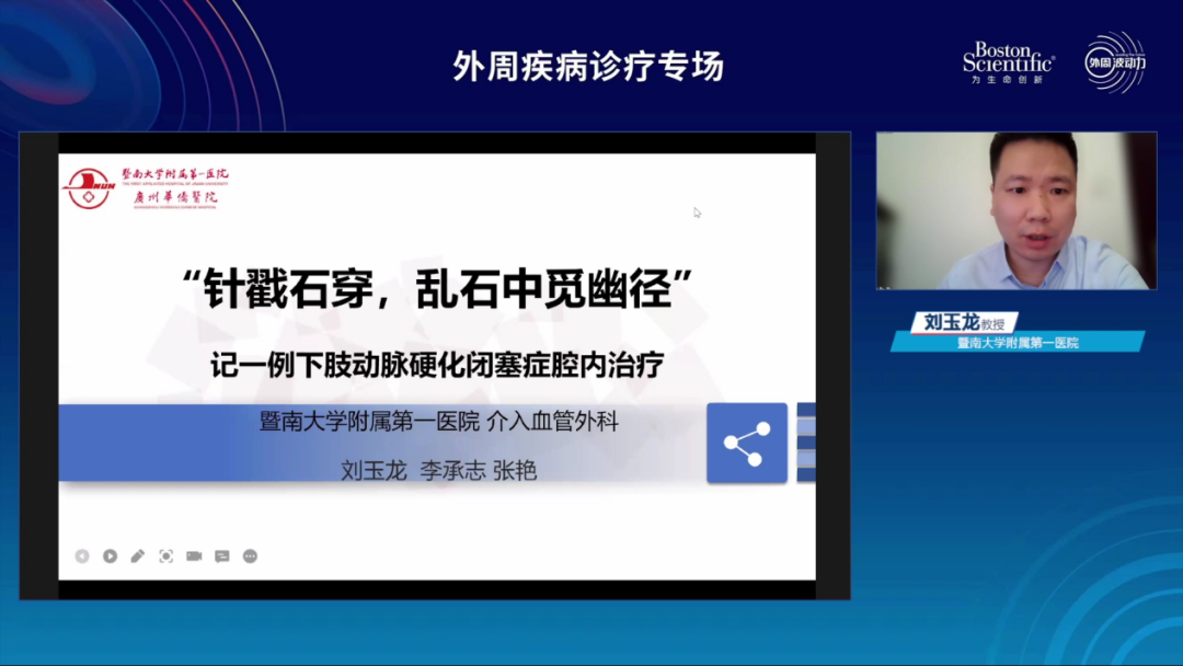 波科支架怎么样精彩荟萃 ｜ 波士顿科学 外周波动力【下肢篇】@中国南方血管大会_https://www.jmylbn.com_新闻资讯_第4张