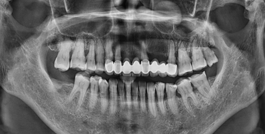 口腔内窥镜怎么用牙周内窥镜，呵护口腔健康_https://www.jmylbn.com_新闻资讯_第8张