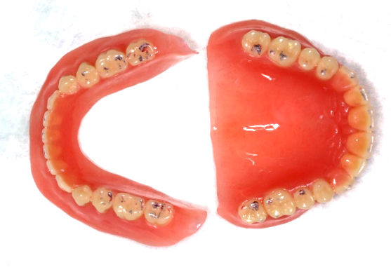 口腔吸盘怎么安装像“吸盘”一样的吸附性义齿——无牙𬌗的福音!_https://www.jmylbn.com_新闻资讯_第4张