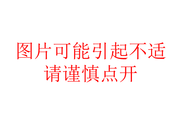 口腔内窥镜怎么用牙周内窥镜，呵护口腔健康_https://www.jmylbn.com_新闻资讯_第9张