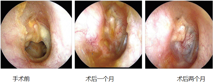 耳朵内窥镜什么样【红旗科普】一文读懂 ｜ 耳内窥镜可以做哪些检查？_https://www.jmylbn.com_新闻资讯_第21张