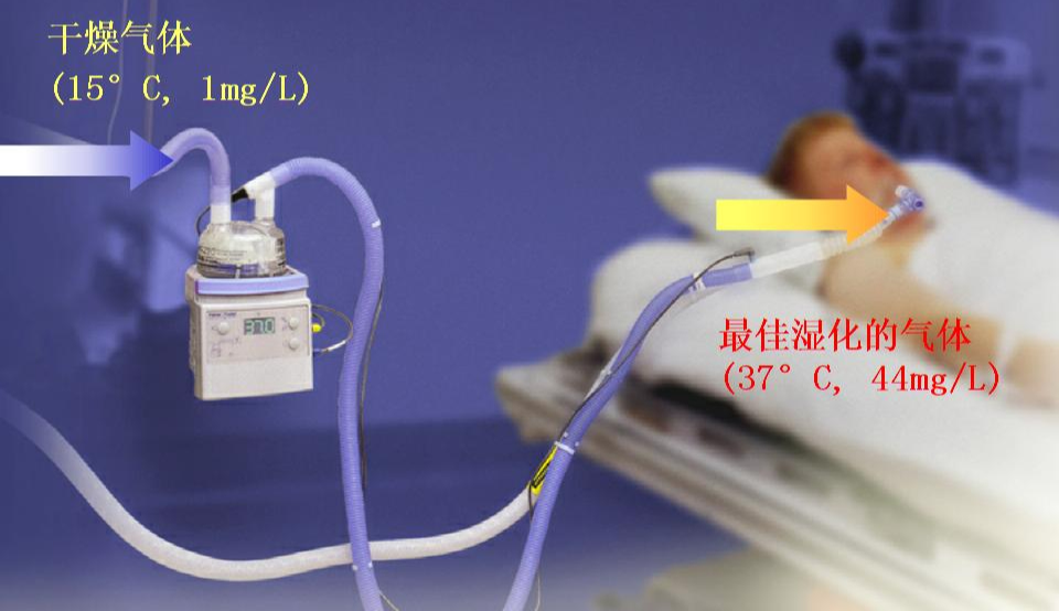 呼吸机怎么选择气切后如何选择呼吸机？一篇文章教会你！_https://www.jmylbn.com_新闻资讯_第10张