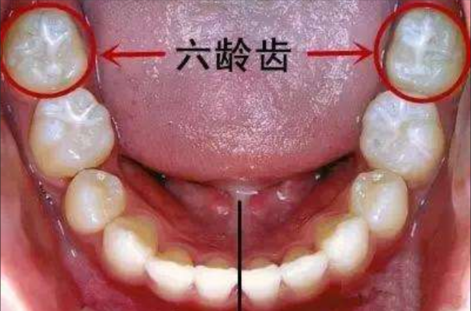 曲面断层片怎么看换牙与身高有关吗？关于孩子换牙的所有疑问一篇说清_https://www.jmylbn.com_新闻资讯_第24张