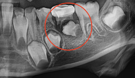 曲面断层片怎么看换牙与身高有关吗？关于孩子换牙的所有疑问一篇说清_https://www.jmylbn.com_新闻资讯_第26张