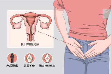 产后康复治疗仪怎么用乌沙医院引进超声子宫复旧治疗仪：让TA恢复如初 重现女性光彩_https://www.jmylbn.com_新闻资讯_第12张