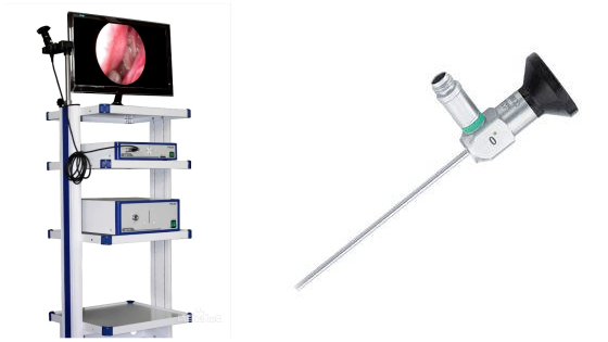 耳朵内窥镜什么样耳朵检查：用“放大镜”揪出隐藏的“小坏蛋”_https://www.jmylbn.com_新闻资讯_第6张
