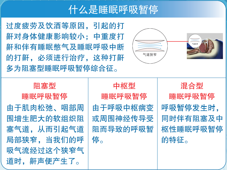 什么是睡眠呼吸机WHAT! ｜ 呼吸机治疗睡眠呼吸暂停综合征？_https://www.jmylbn.com_新闻资讯_第6张