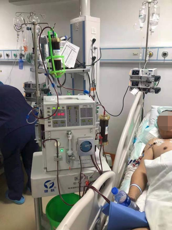 医讯怎么用『附一医讯』高脂血症性胰腺炎治疗“神器”再显神威！我院EICU使用血液灌流治疗，让多名危重患者度过难关_https://www.jmylbn.com_新闻资讯_第4张