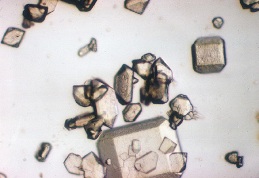 粪沉渣怎么取最新资料整理的尿检图谱：36张图片手把手教你辨认尿液中的鸟粪石结晶_https://www.jmylbn.com_新闻资讯_第7张