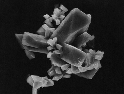 粪沉渣怎么取最新资料整理的尿检图谱：36张图片手把手教你辨认尿液中的鸟粪石结晶_https://www.jmylbn.com_新闻资讯_第37张