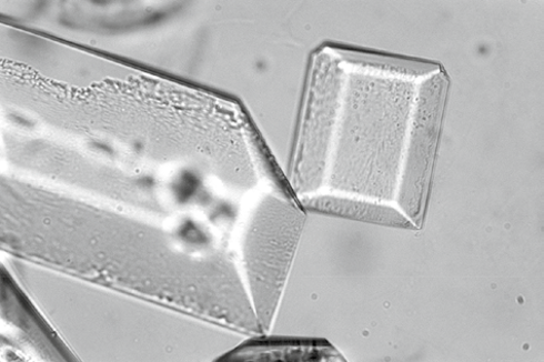 粪沉渣怎么取最新资料整理的尿检图谱：36张图片手把手教你辨认尿液中的鸟粪石结晶_https://www.jmylbn.com_新闻资讯_第5张