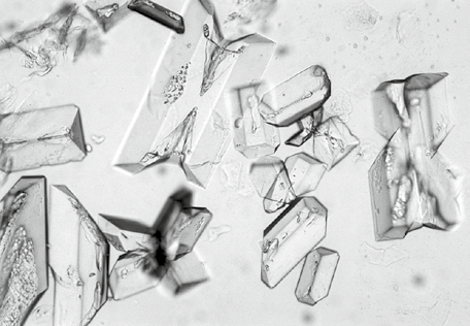 粪沉渣怎么取最新资料整理的尿检图谱：36张图片手把手教你辨认尿液中的鸟粪石结晶_https://www.jmylbn.com_新闻资讯_第4张